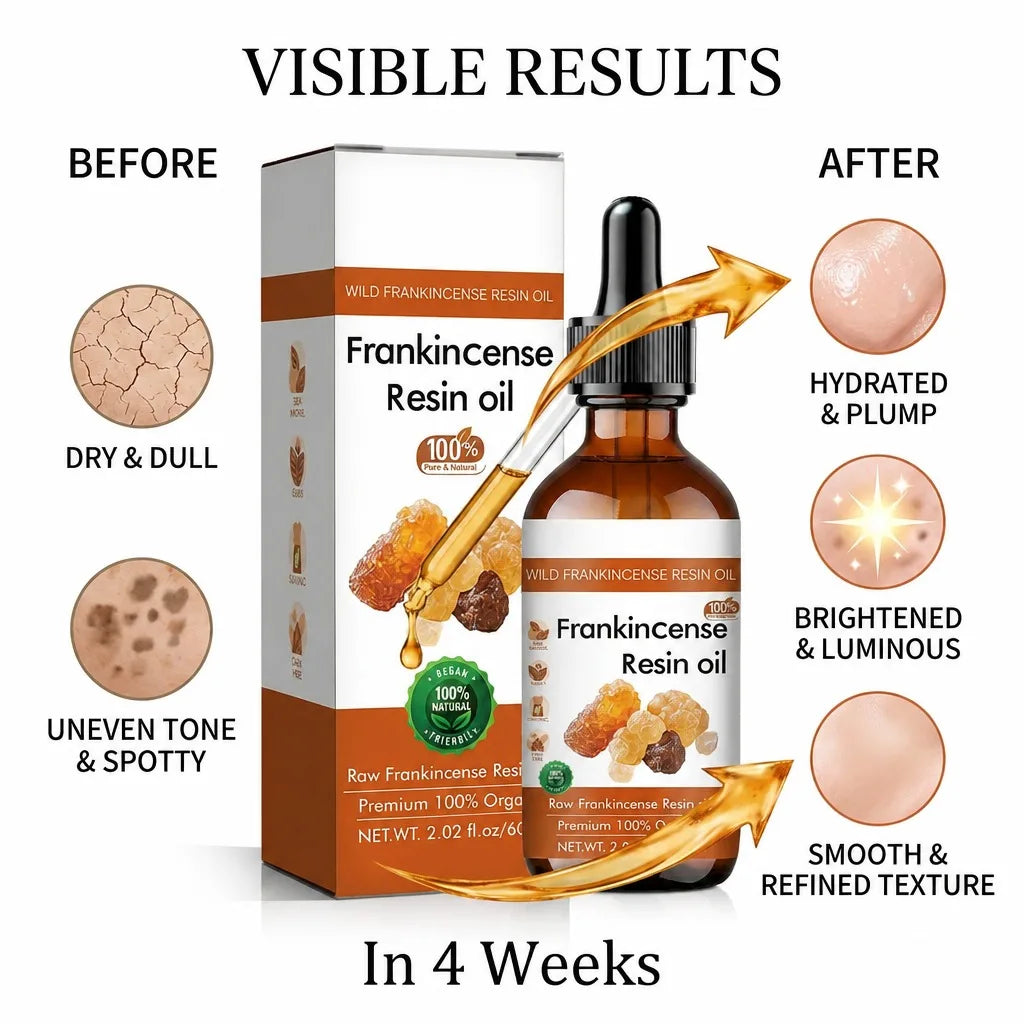 Wild Frankincense Resin Facial Essence Oil – 100% Natural
