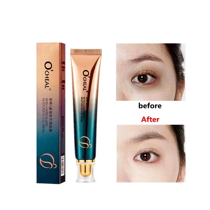 Retinol Eye Cream – Firming, Hydrating & Nourishing | 30g