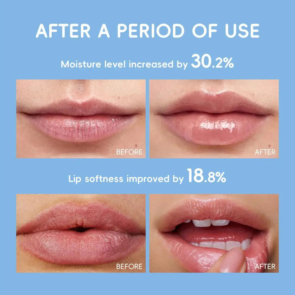 Milk Nourishing Lip Balm – Shea Butter, Jojoba & Hyaluronic Acid