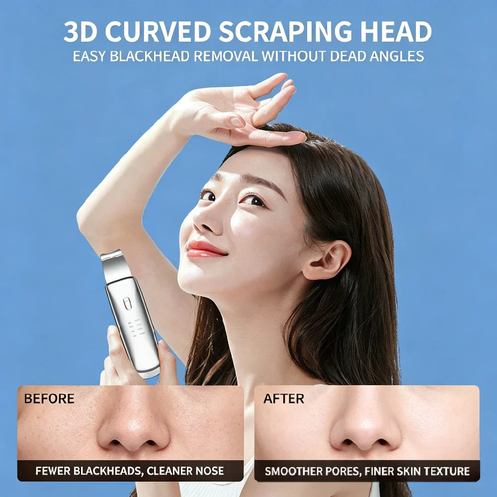 Ultrasonic Skin Scrubber 4-Mode Facial Pore Cleanser Spatula