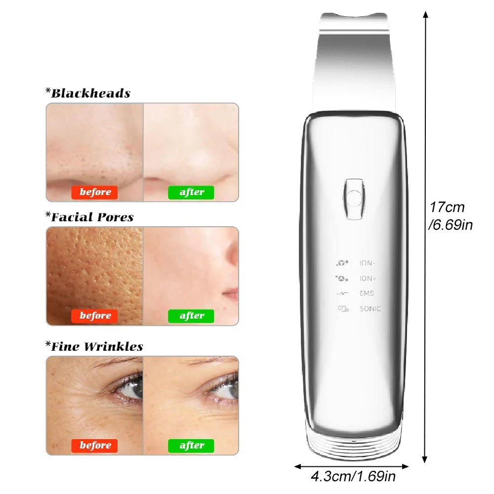 Ultrasonic Skin Scrubber 4-Mode Facial Pore Cleanser Spatula