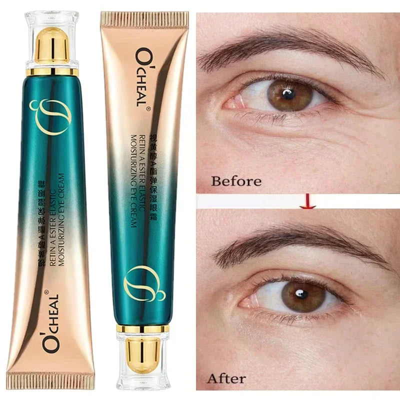 Retinol Eye Cream – Firming, Hydrating & Nourishing | 30g