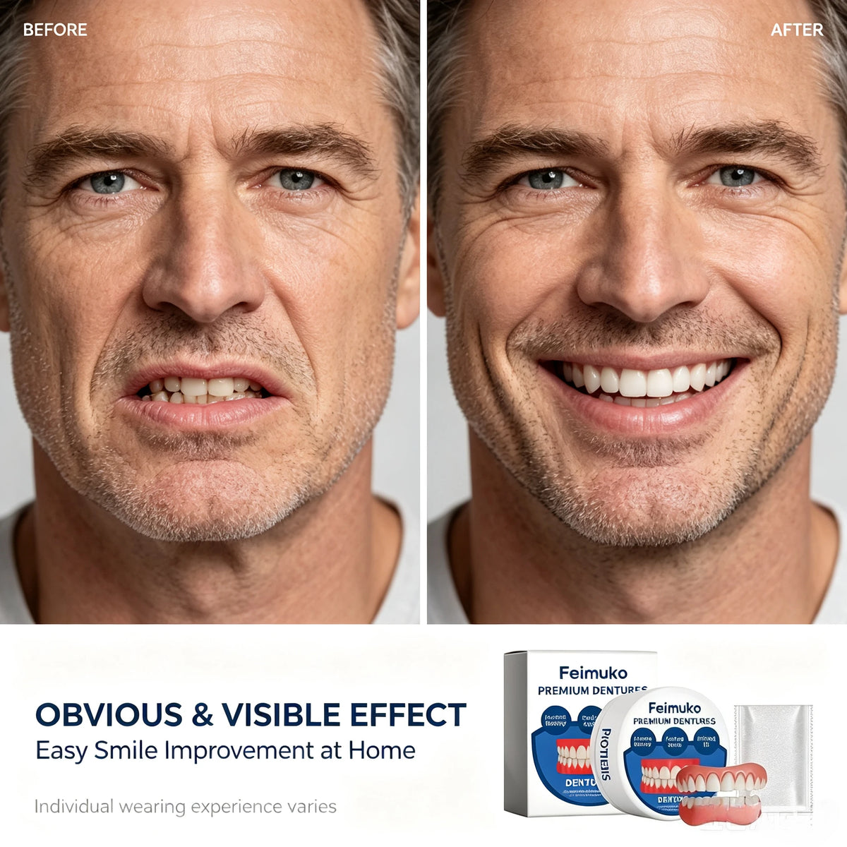 Soft Silicone Snap-On Dentures Full Set – Upper & Lower Teeth