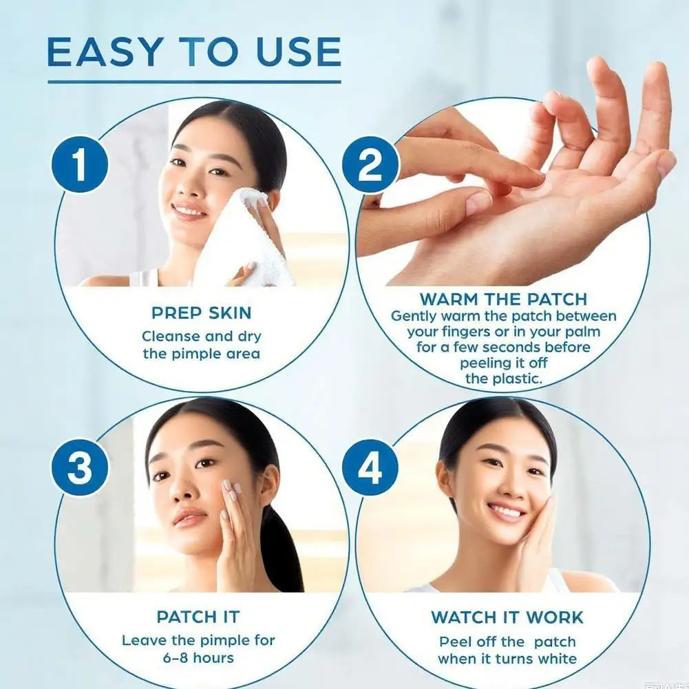Ultra-Thin Star Acne Patches – Multi-Color Concealer Dots