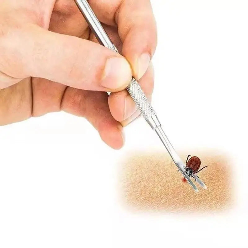 Stainless Steel Tick Fork Remover Tool for Dogs & Cats Pet Tick Remover PRIMED