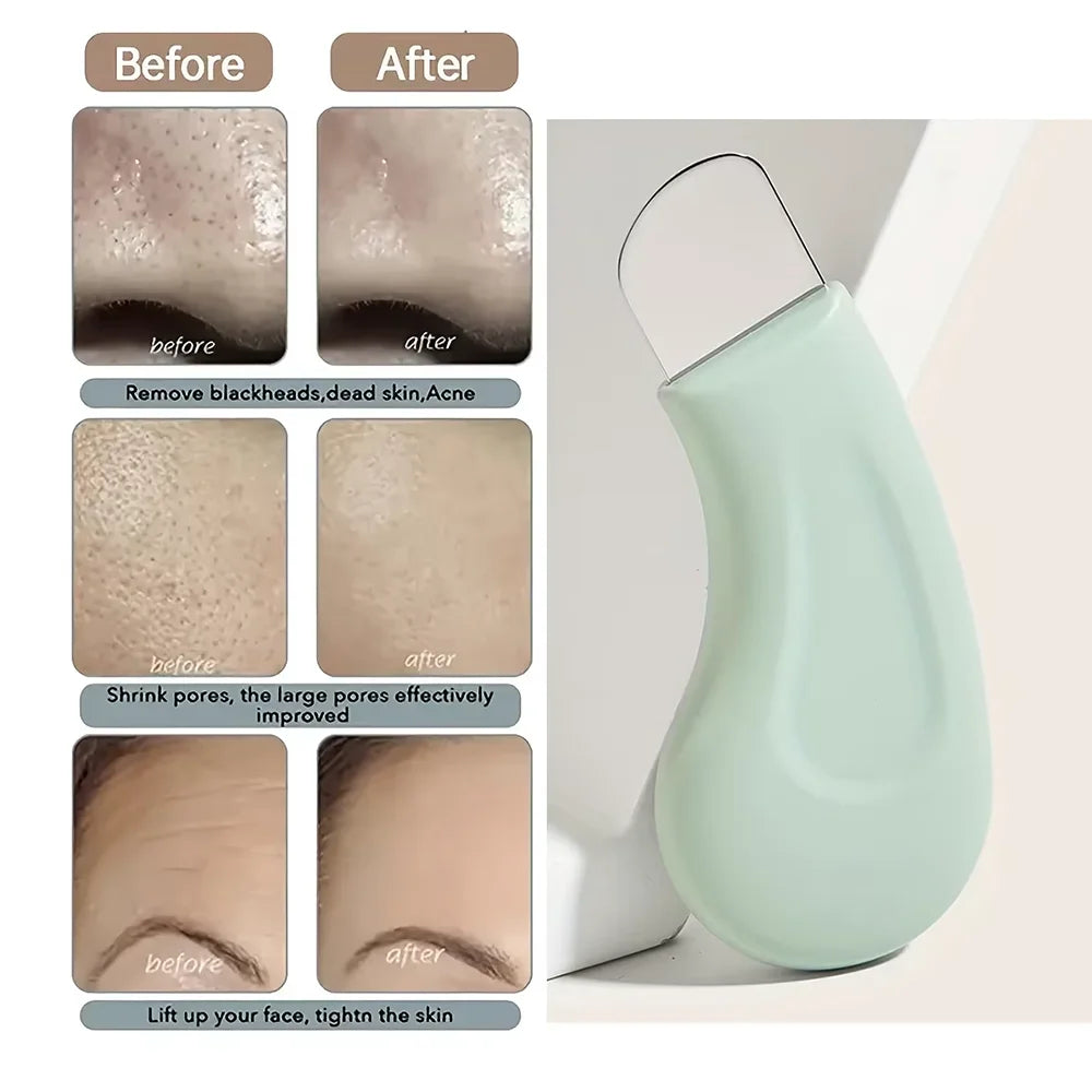 Silicone Facial Scraper & Ice Cooling Pore Cleanser Tool